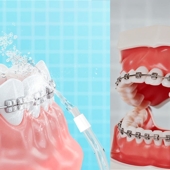 Dental floss vs. water flossers: which truly works better for oral health?