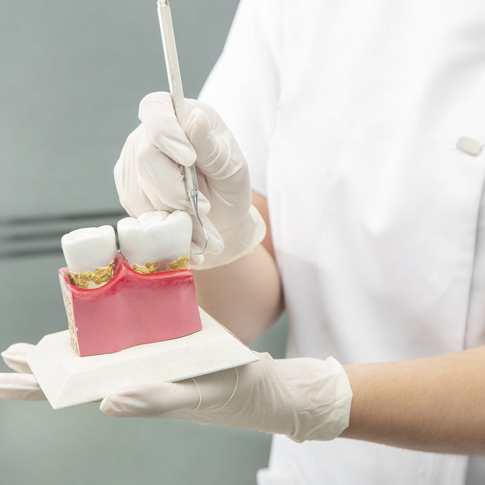 The Ultimate Guide to Preventing Gingivitis | VCIT Oral Care
