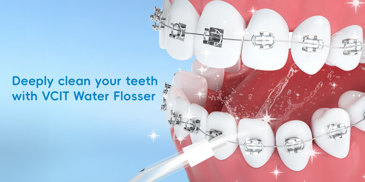Orthodontics care: complete guide to braces hygiene & prevention